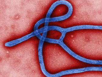 Unprecedented ebola 'epide...